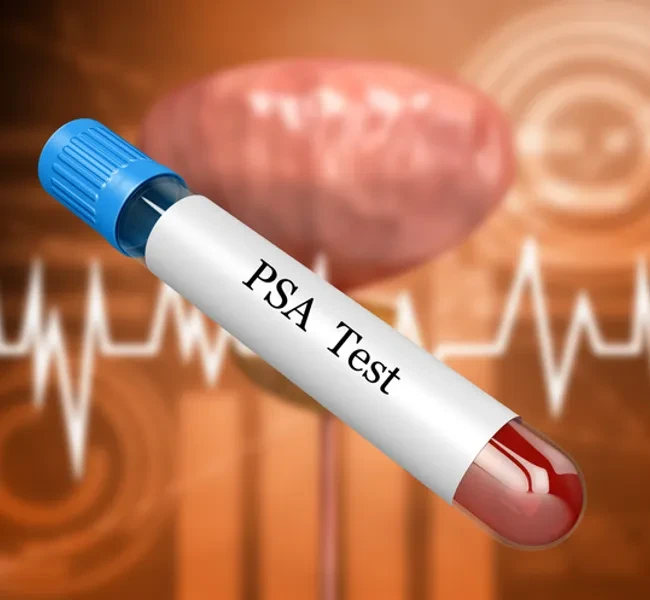 Câncer de Próstata: exame de toque digital é para todos e ...